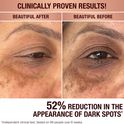 DARK SPOT CORRECTING INVISIBLE UV DUO SKINCARE KIT