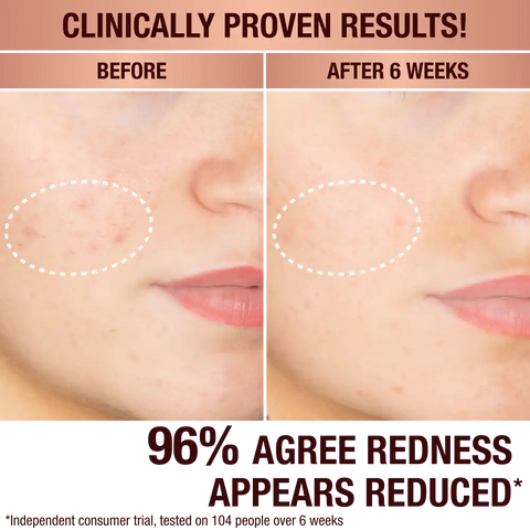 MINI DARK SPOT SERUM + CHARLOTTE’S MAGIC CREAM DUO SKINCARE KIT