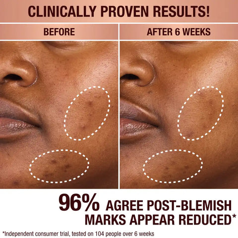 DARK SPOT CORRECTING INVISIBLE UV DUO SKINCARE KIT